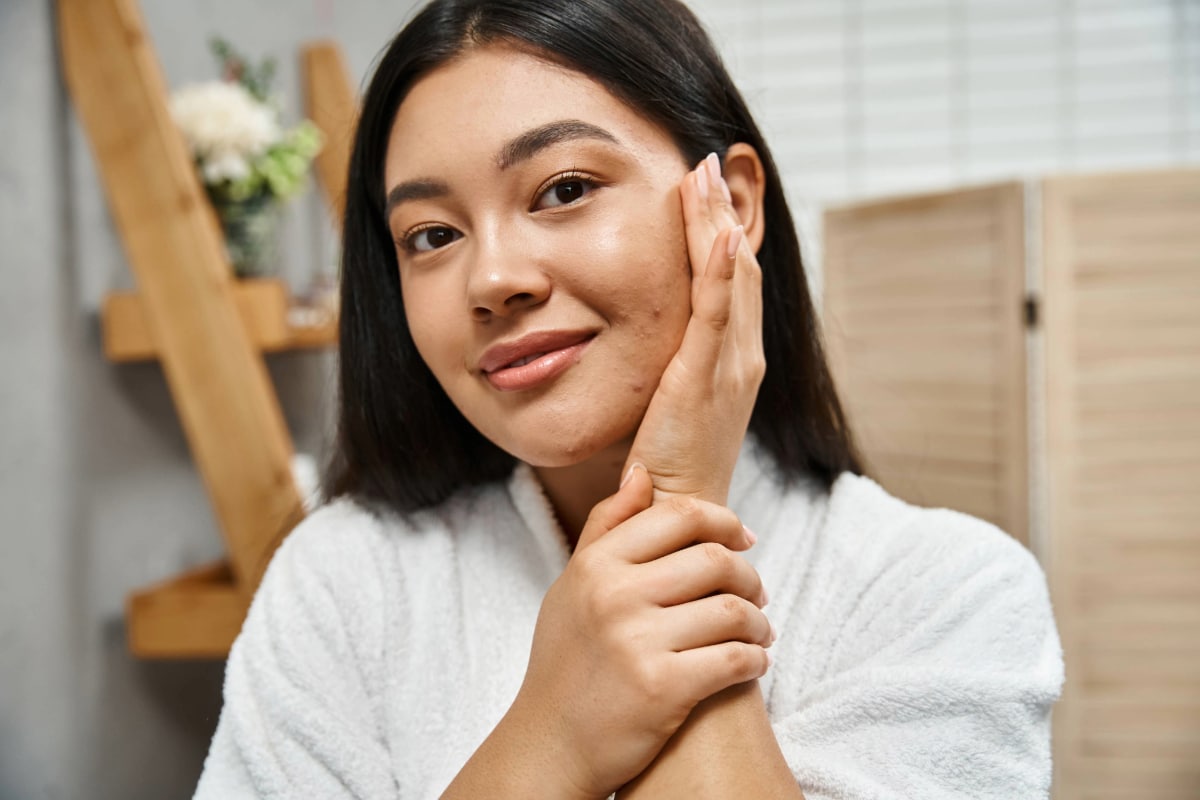 young woman with acne